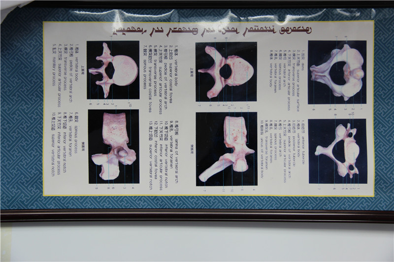 照片说明：鄂尔多斯蒙医正骨术教材 摄影者：敖特根毕力格 时间：2013年4月9日.jpg